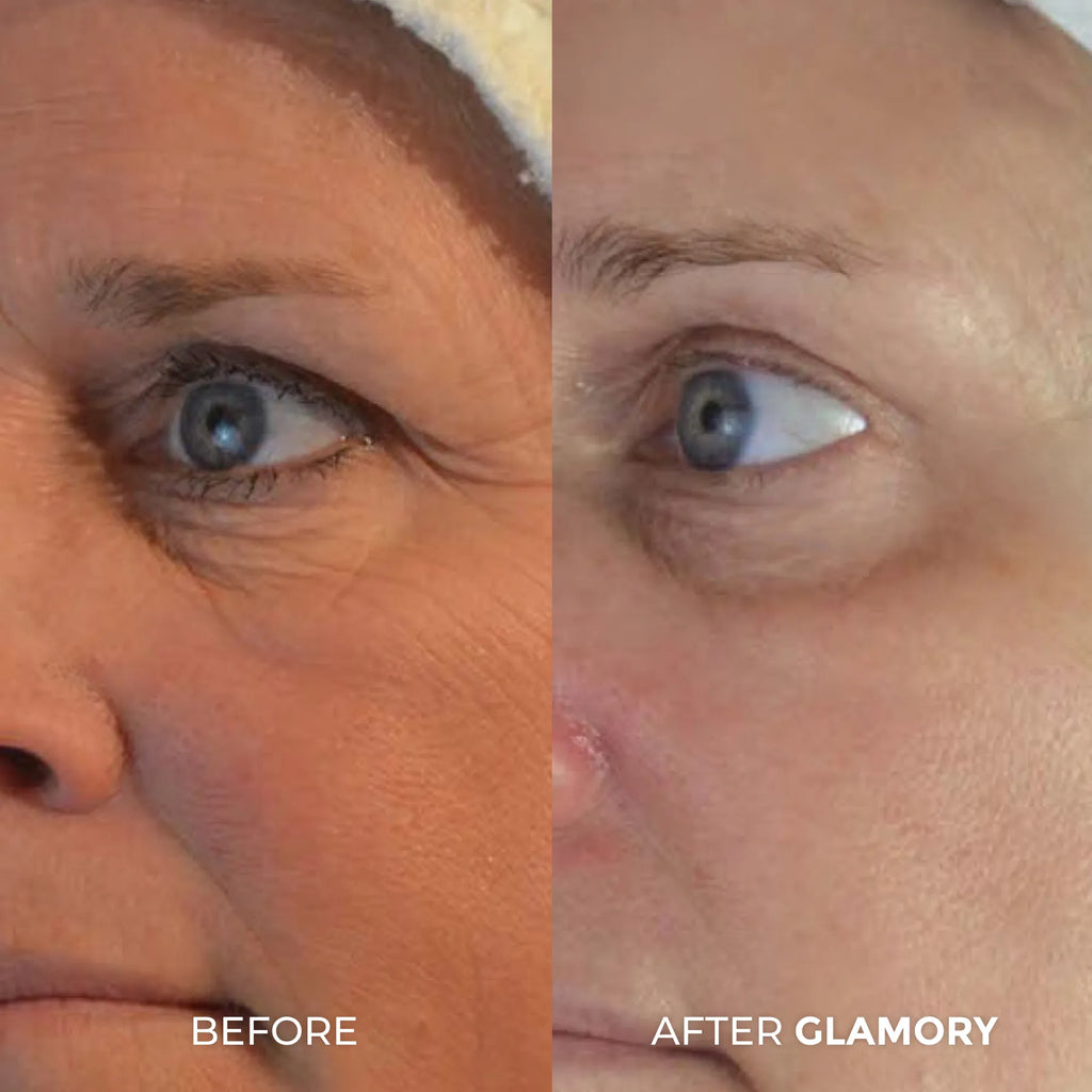 Erase Years of Aging  at Home in Just 5 Minutes