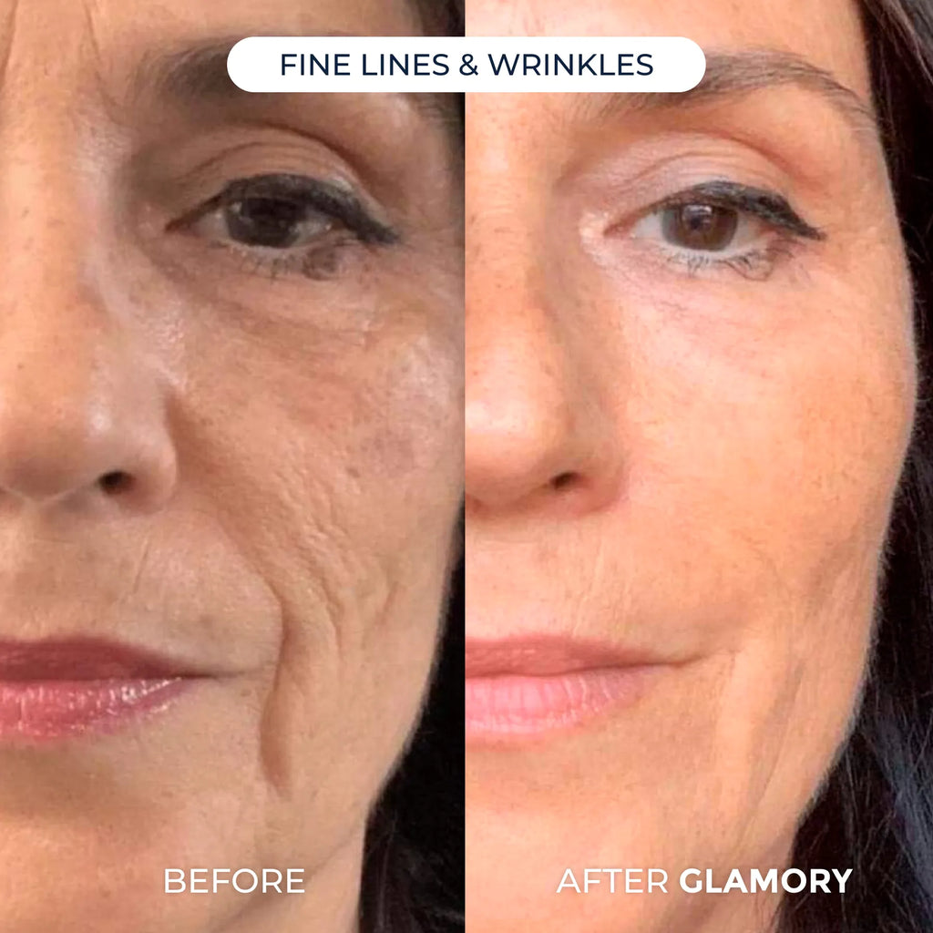 Erase Years of Aging  at Home in Just 5 Minutes